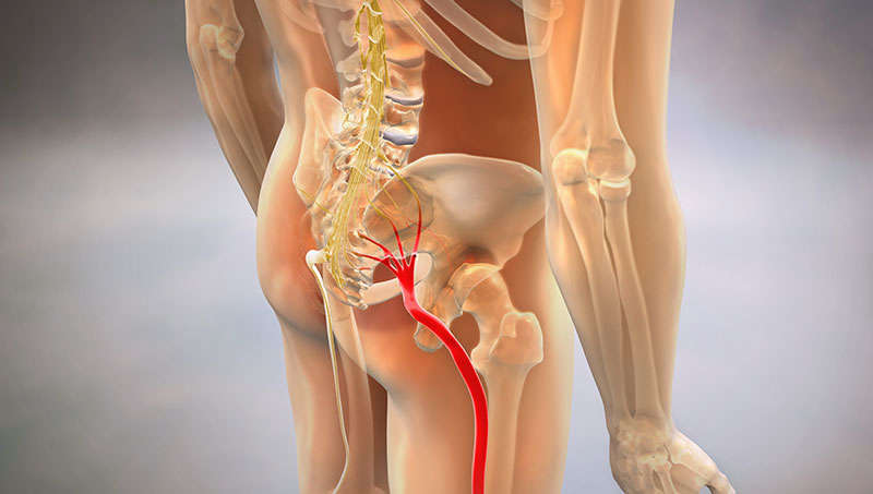 image showing loaction of sciatic nerve